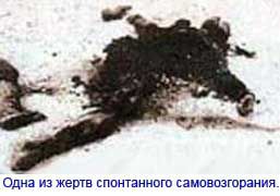 Феномен самовозгорания человека Феномен самовозгорания человека