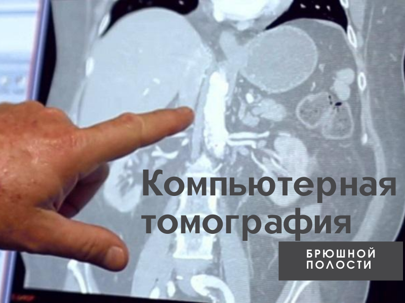 Компьютерная томография 