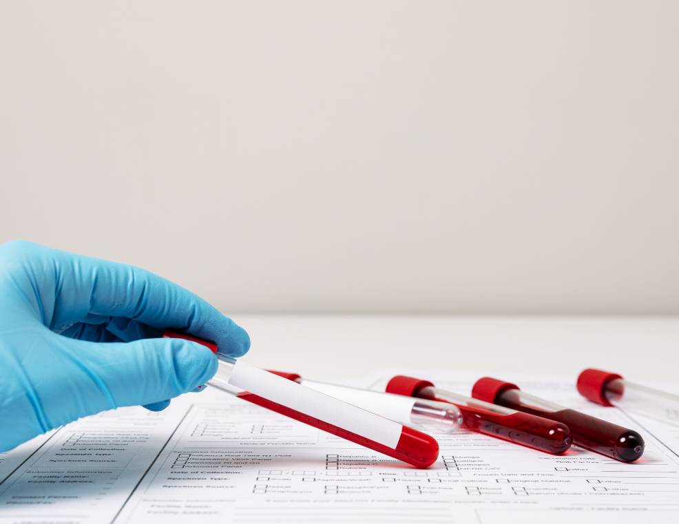 Сдача анализов на онкомаркеры