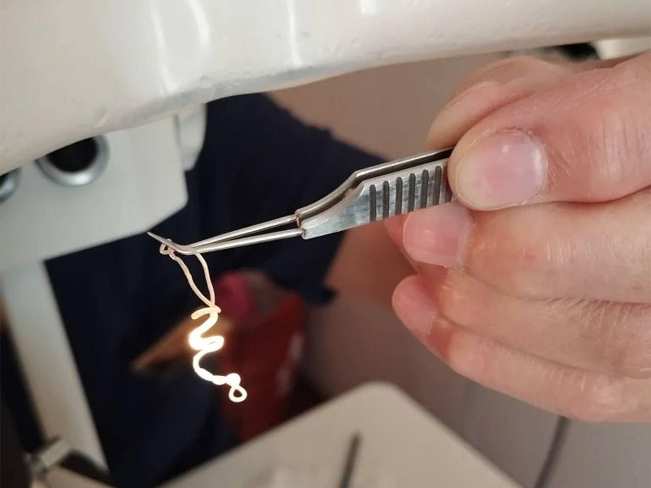 Хирурги извлекли 20-сантиметрового живого червя из глаза мужчины после укуса комара